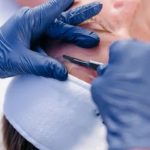 Dermaplaning behandeling bij Bij Viv